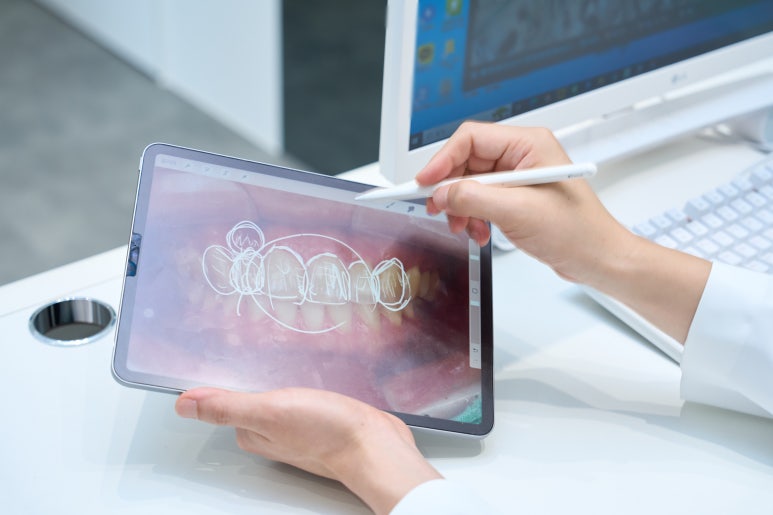 무삭제 라미네이트 부작용? 관련 이미지 3