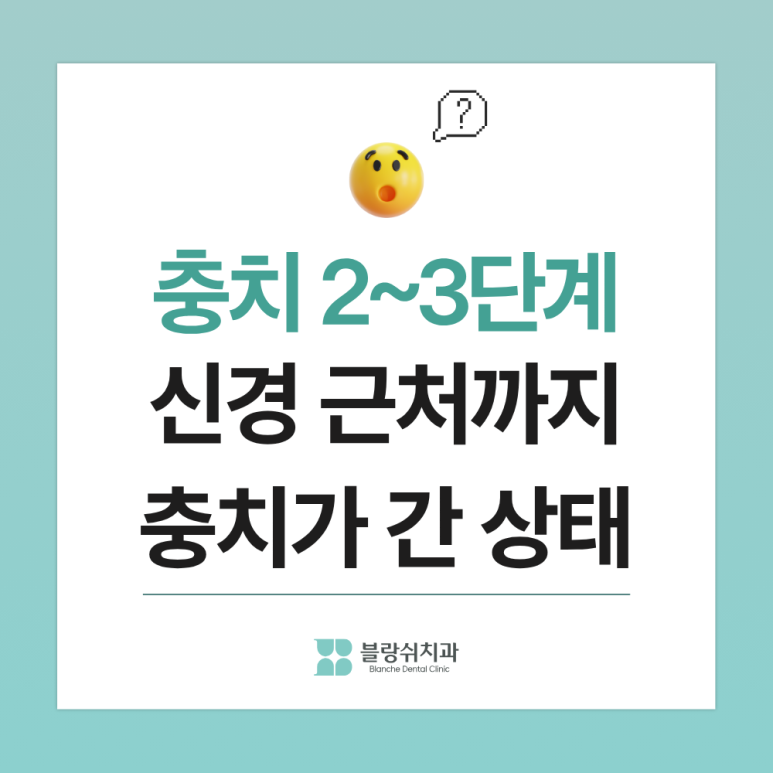 어린이 충치치료, 신경치료 안 가는 골든타임과 치료법 정리 관련 이미지 4