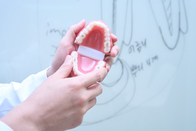 풀아치 임플란트 치과, 장점 대상 과정 기간 등 총정리해드립니다 -의사 작성 관련 이미지 4