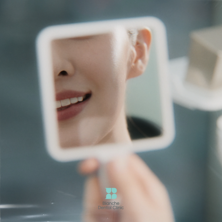 3 Common Traits of People Who Regret Their Veneers image 4