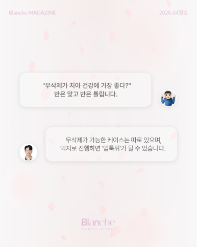 무삭제 라미네이트? 누구나 할 수 없는 진짜 이유 관련 이미지 4