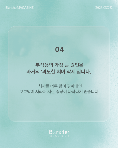 옛날에 한 라미네이트, 요즘 자꾸 신경 쓰인다면? 관련 이미지 7