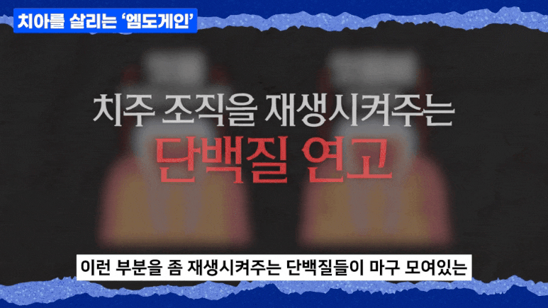 엠도게인, 논현역 치과에서 잇몸 살리는 방법을 말씀드립니다 관련 이미지 6