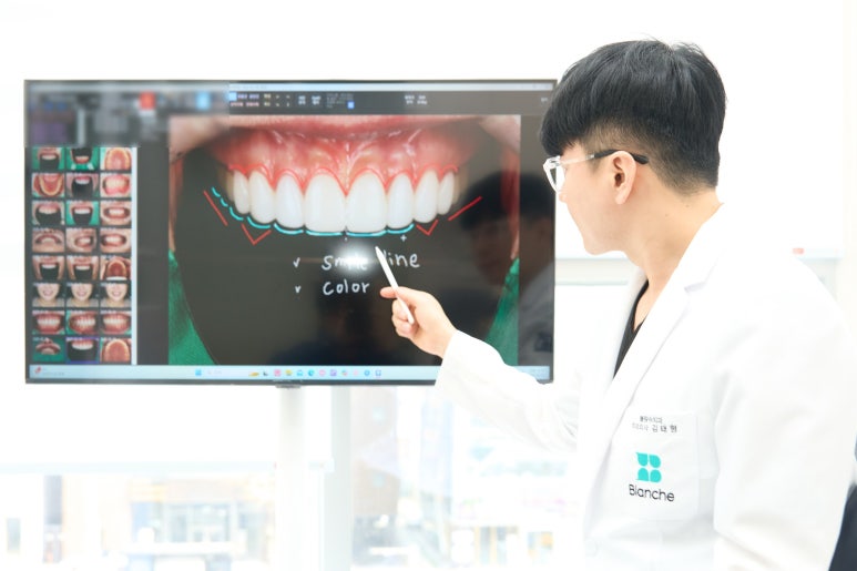 무삭제라미네이트후기, 비밀 폭로합니다 <현직의사 작성> 관련 이미지 3