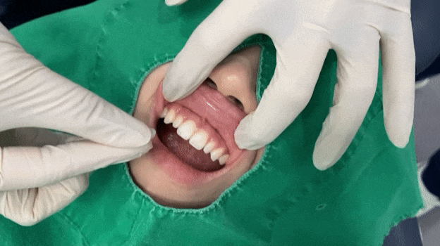 블랑쉬 부작용 문의? 관련 이미지 10