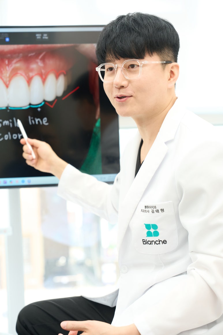 라미네이트 치아삭제, 0.1mm가 바꿔놓는 것들이 있습니다 관련 이미지 4