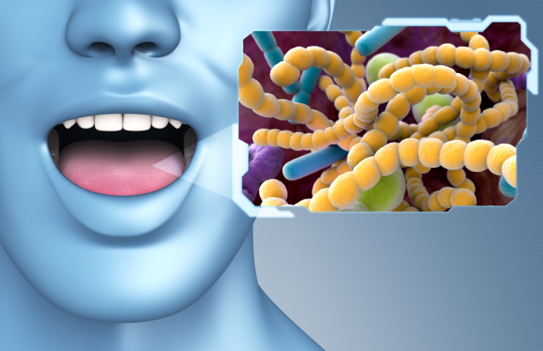 You Brush Thoroughly, but Still Have Bad Breath? 4 Real Causes Your Toothbrush Can’t Reach image 2