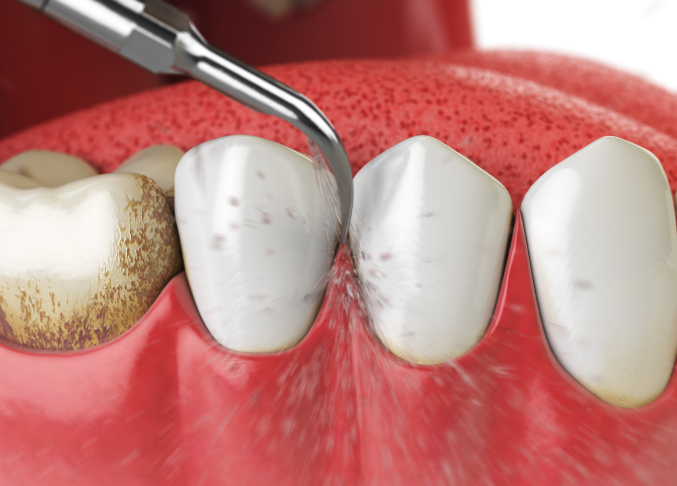 치과 가기 무서운 이유 3가지 — 원인을 알면 절반은 해결됩니다 관련 이미지 6