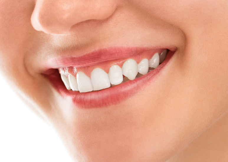 What People Who Received Gummy Smile Botox Asked Most Often image 2
