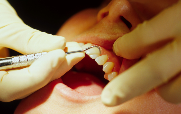 The Real Reason Gums Break Down After Your 50s: A Dentist’s Picks for Foods to Eat vs. Foods to Avoid image 8