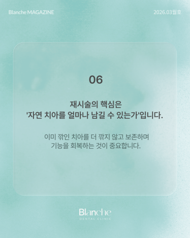 옛날에 한 라미네이트, 요즘 자꾸 신경 쓰인다면? 관련 이미지 10