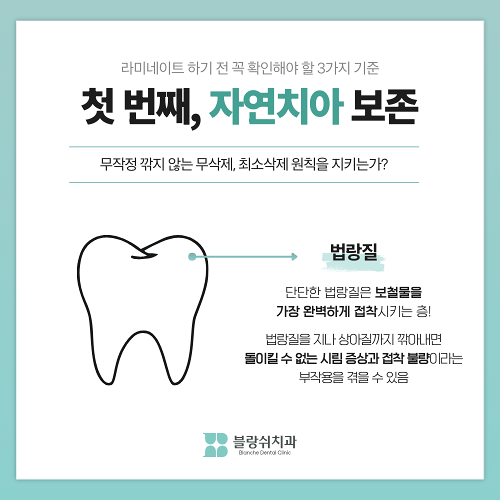 내근처치과 라미네이트 잘하는곳 찾는 기준 관련 이미지 3