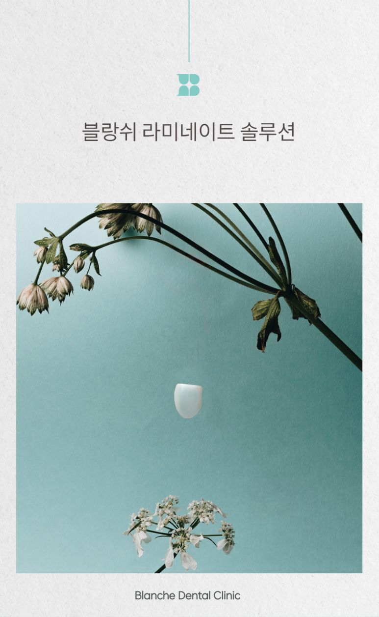 If You’ve Been 고민ning About the Price of Blanche Laminate, This Article Is Enough. image 2
