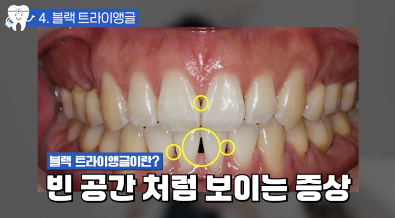압구정치과 치아교정이 고민이라면 필독 관련 이미지 15