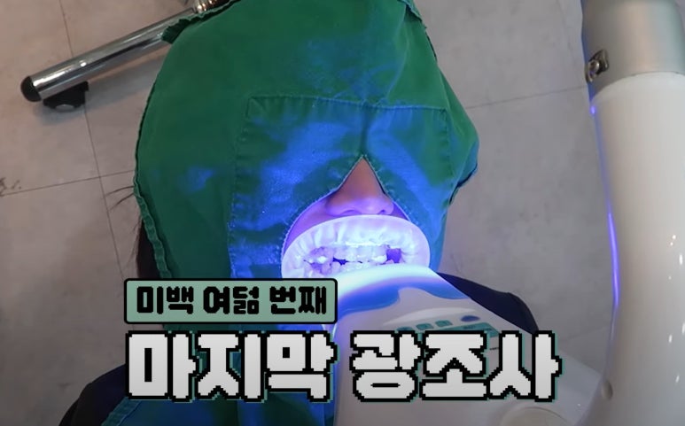 치아미백 시술,  시간과 가격 한계점까지 알려드립니다. 관련 이미지 10