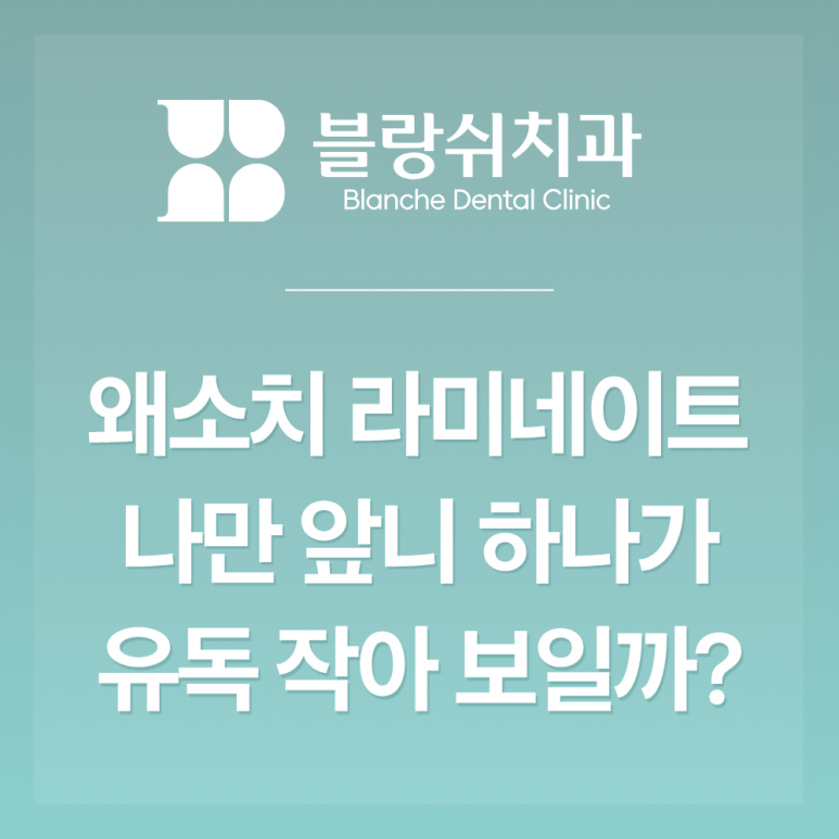 반포 왜소치 라미네이트 작은 앞니(옆니) 하나가 계속 신경 쓰이는 분들이 궁금해하는 3가지 관련 이미지 2