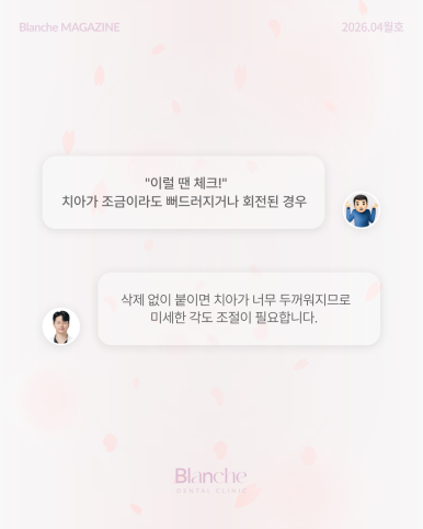 무삭제 라미네이트? 누구나 할 수 없는 진짜 이유 관련 이미지 11