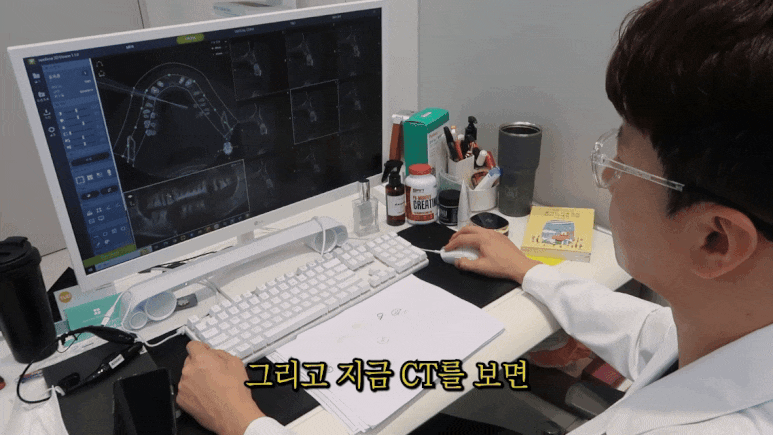 논현치과 임플란트 누적 30,000개 이상 식립한 치과 원장의 임플란트 Q&A 총정리 관련 이미지 13