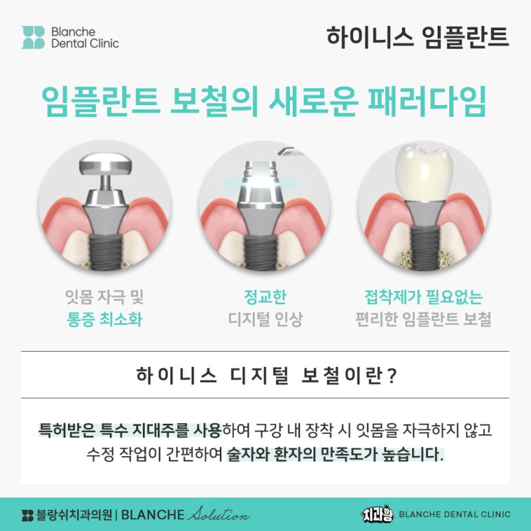 수면임플란트센터, 프리미엄 임플란트 진료는 블랑쉬치과(Blanche Dental Clinic) 관련 이미지 29