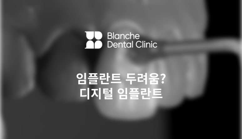 임플란트가 두렵다면 반드시 읽으세요! 관련 이미지 3