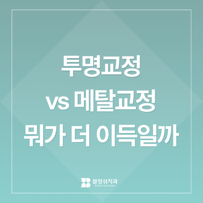 투명교정 vs 메탈교정 비용 비교, 뭐가 더 이득일까? 관련 이미지 1