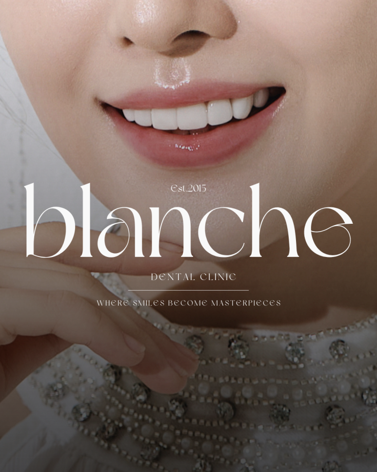 블랑쉬 모든 궁금증 해결해 드립니다 [Q&A] 관련 이미지 1