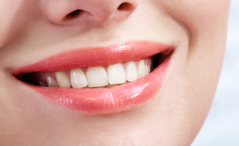 투명교정 vs 메탈교정 비용 비교, 뭐가 더 이득일까? 관련 이미지 4