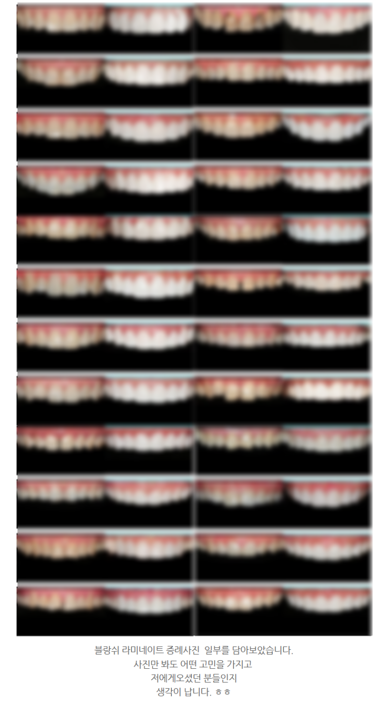 무삭제라미네이트비용, 가격만 봤다면 필독 관련 이미지 1