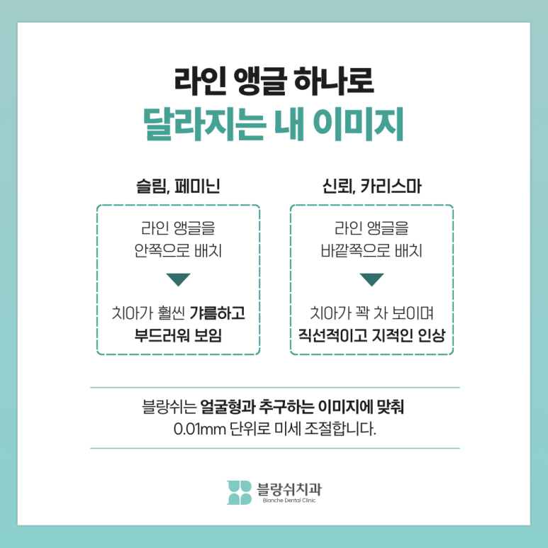 연예인 라미네이트 티 안나고 자연스러운 이유 관련 이미지 8