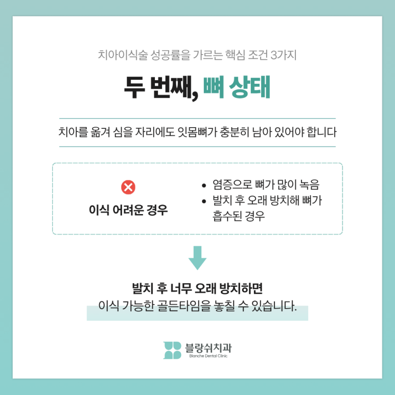 치아이식술 성공률 높이는 핵심 조건 3가지, 임플란트 전에 꼭 읽어보세요 관련 이미지 6