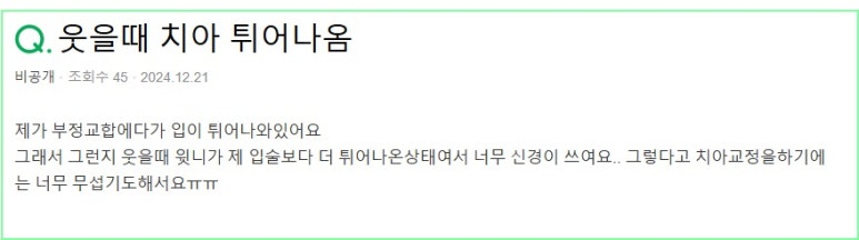 앞니 라미네이트 시술 왜 자꾸 망설이게 될까요? 관련 이미지 1