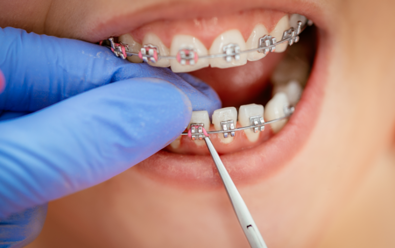 Tongue Tip Pain and Tongue Root Pain: Dentists Suspect Different Causes Depending on the Location image 4