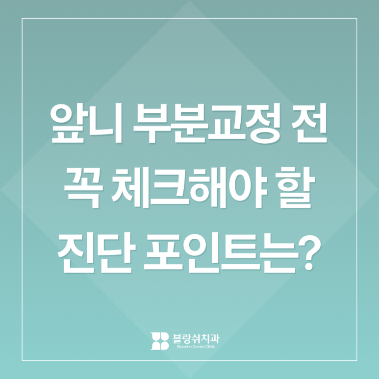 발치 없이 가능할까? 앞니 부분교정 전 반드시 체크해야 할 진단 포인트 관련 이미지 1