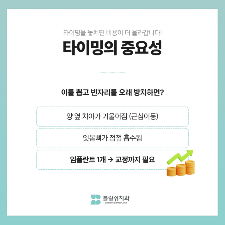 부분임플란트, 하나만 심으면 되는데 왜 비용 차이가 3배까지 날까? 관련 이미지 9