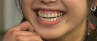 인생을 바꾸고 싶다면, 미소를 바꾸세요. 관련 이미지 9