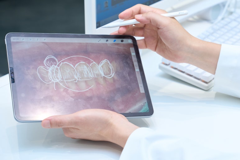 앞니 라미네이트 가격, 자연치아 보존이 우선이라면 관련 이미지 16