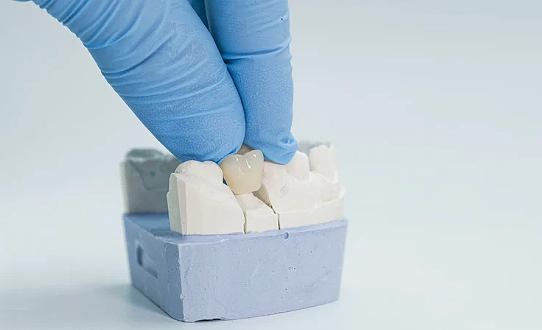 충치치료 비용 건강보험 적용 기준은 관련 이미지 8