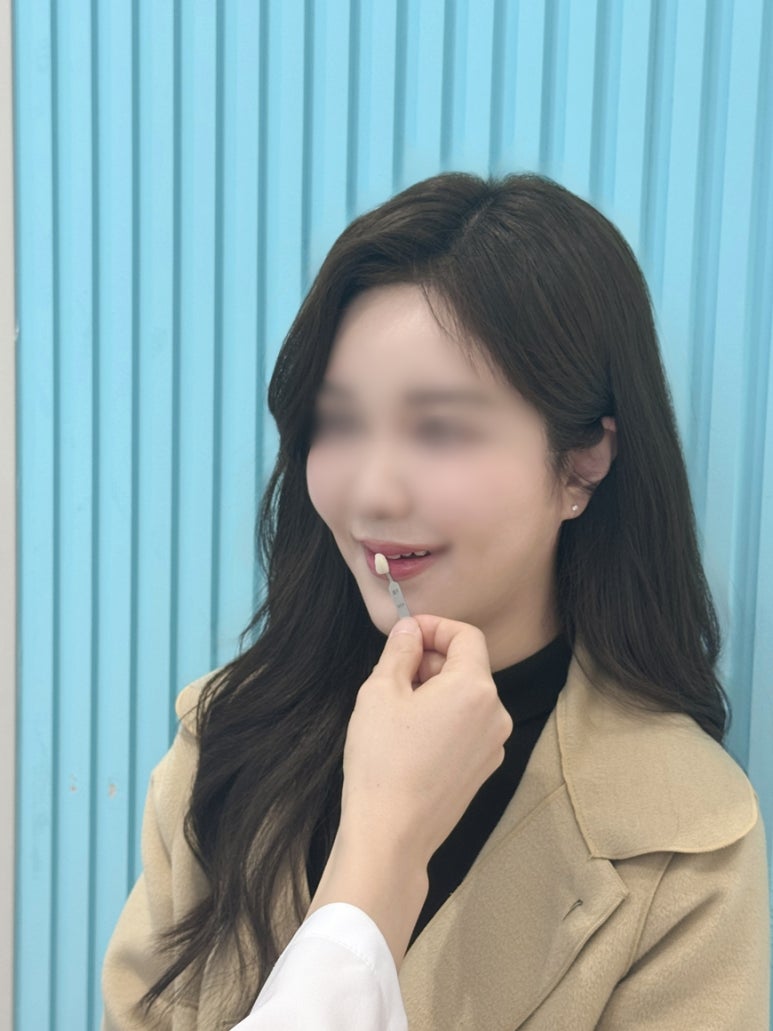 치아 라미네이트, 자연스러움을 위해 비교하고 있다면? 관련 이미지 4