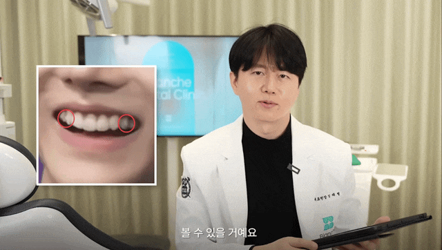 A Dentist’s Analysis of ALPHA DRIVE ONE’s Teeth image 5