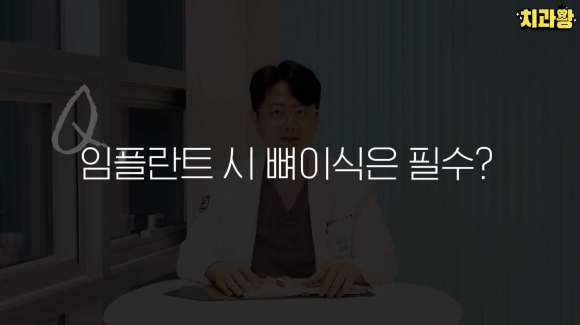 어금니 임플란트 뼈이식 통증 비용 총정리 관련 이미지 8