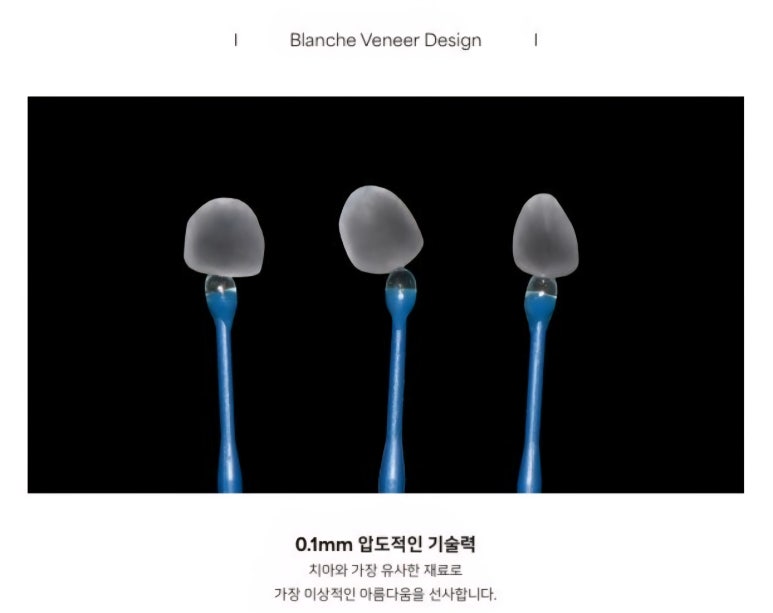치아미백 시술? 블랑쉬? 어떤 것이 좋을지 고민된다면 관련 이미지 11