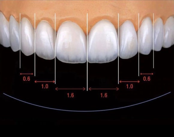 라미네이트 부작용 치아 삭제 전 반드시 알아야 할 것 관련 이미지 5