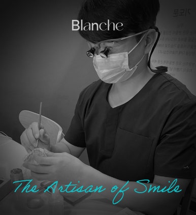 이제 라미네이트 말고 관련 이미지 4