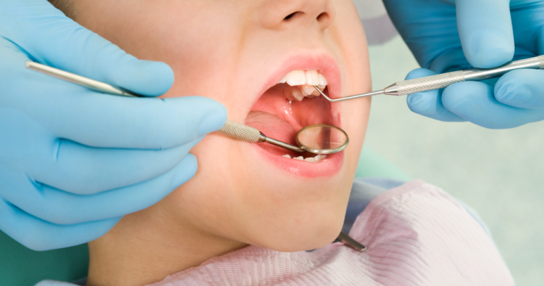 The Golden Time for Children’s Orthodontic Treatment | Signs by Age and Invisalign First image 6