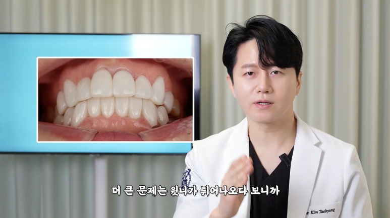 라미네이트 부작용 치아 삭제 전 반드시 알아야 할 것 관련 이미지 8