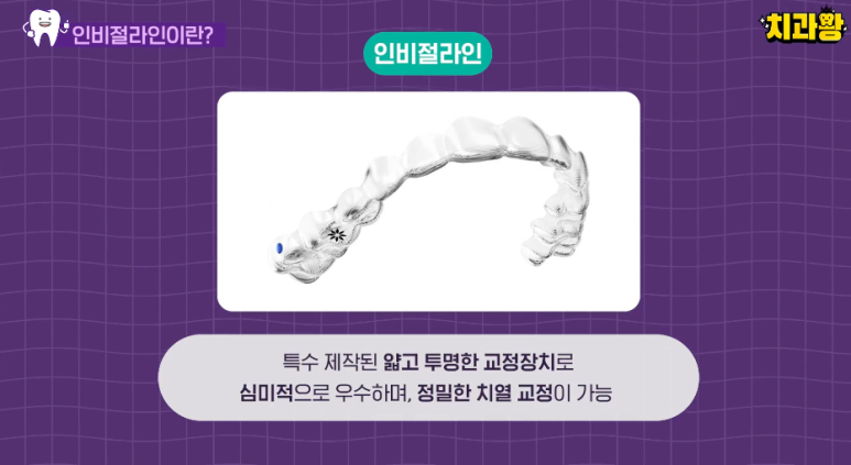 투명교정 vs 메탈교정 비용 비교, 뭐가 더 이득일까? 관련 이미지 6