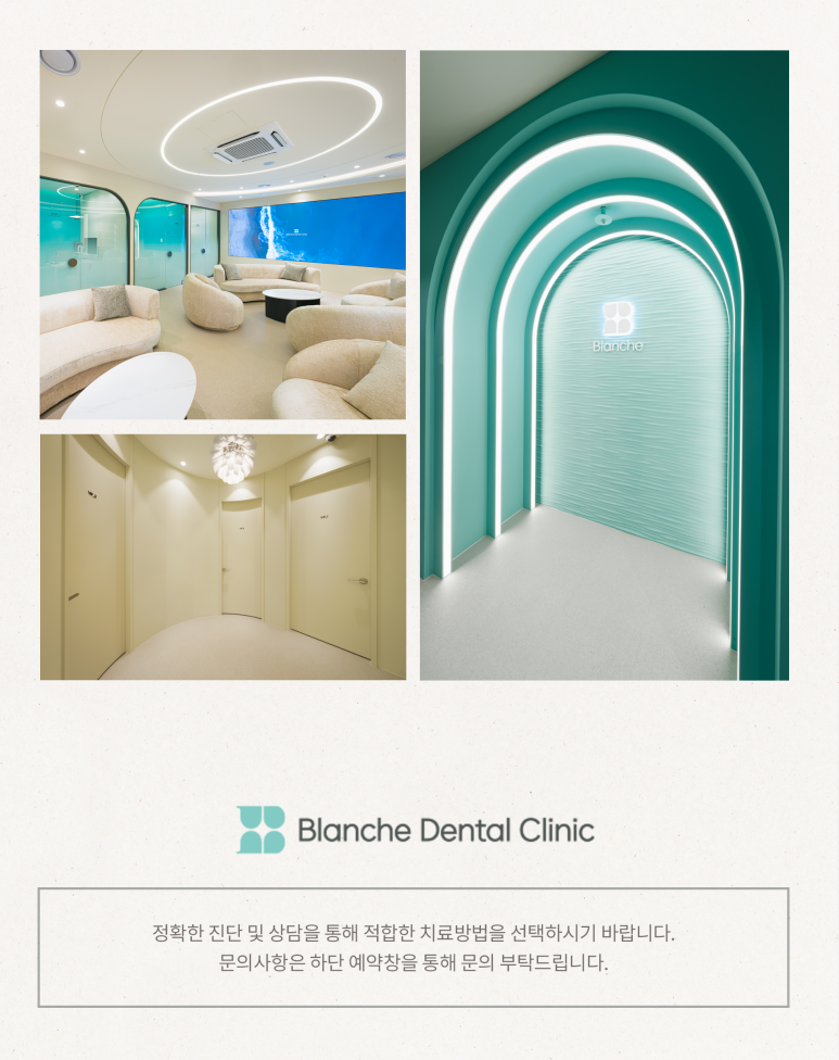 풀아치 임플란트 대상, 치료 시기와 기준을 알려드립니다 관련 이미지 9