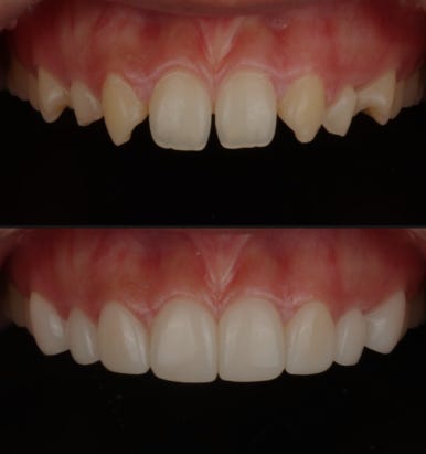 무삭제라미네이트 가격, 어떤 점을 알아보면 좋을까요? 관련 이미지 5