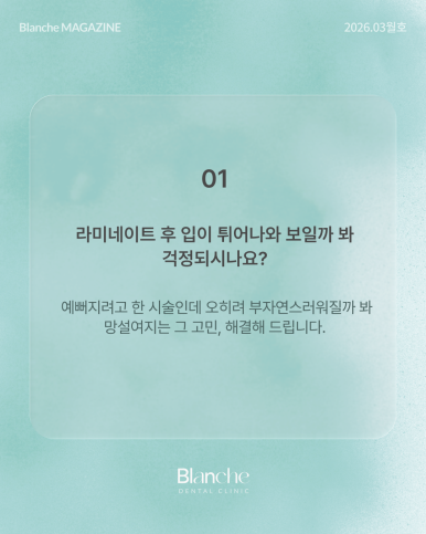 라미네이트 후 관련 이미지 2