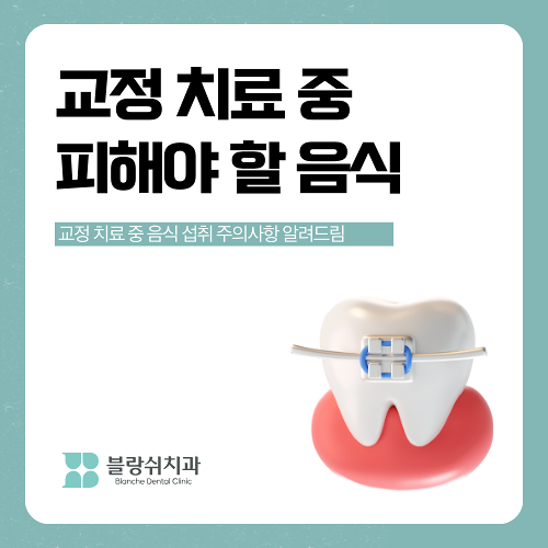 반포동 치과 교정 치료 중 음식 섭취 주의사항 (꼭 피해야 할 음식 vs 추천 음식) 관련 이미지 1